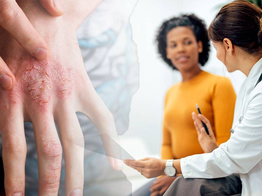 Atopic dermatitis: symptoms, causes, diagnosis, treatment.
